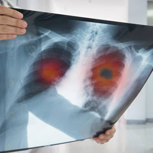 Accuracy and hygiene in Diagnostics